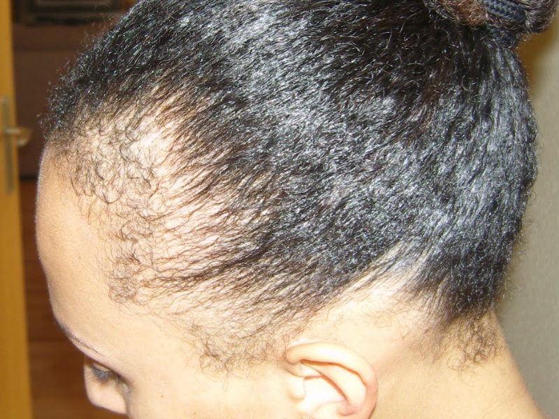 Cure de 3 mois cheveux court